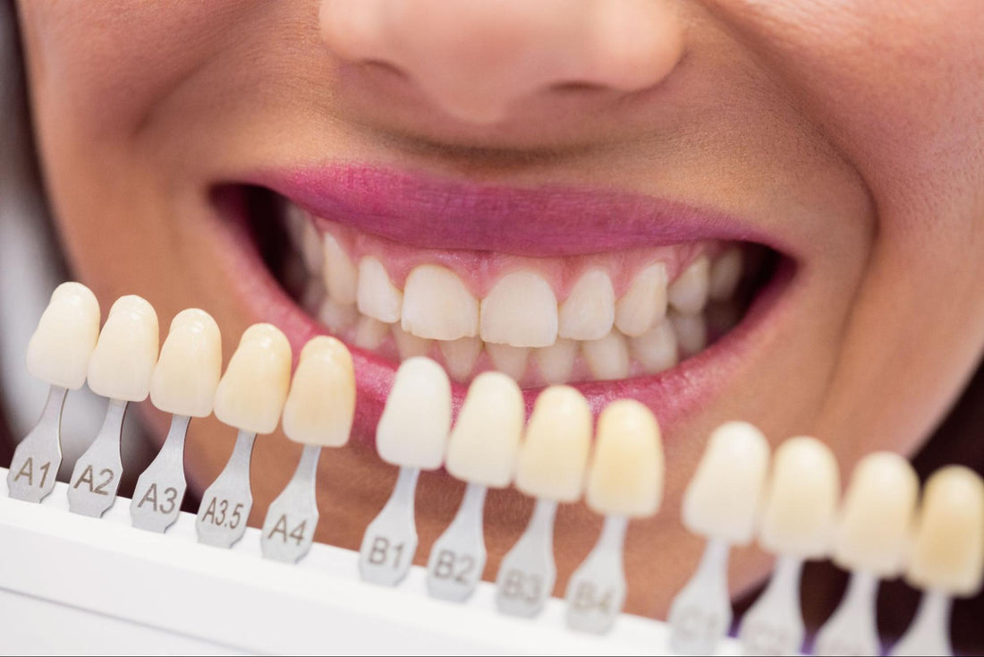 Mastering CEREC Restorations: A Dentist's Guide to Optimizing Material Selection