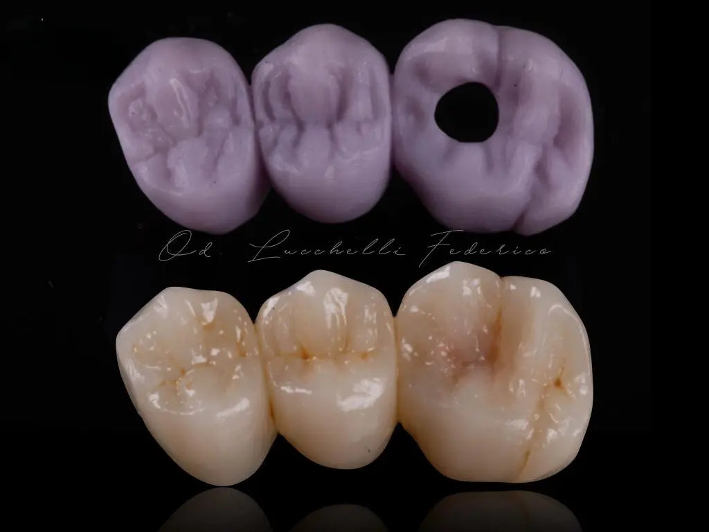 CEREC® Bridge Blocks Lithium Disilicate (e.max) B40