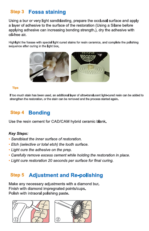 Fossa staining, bonding, CEREC® Blocks - Hybrid Composite Multi Layer x5