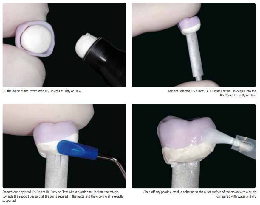 Peg Putty Object Fix e.max Firing - CEREC Depot