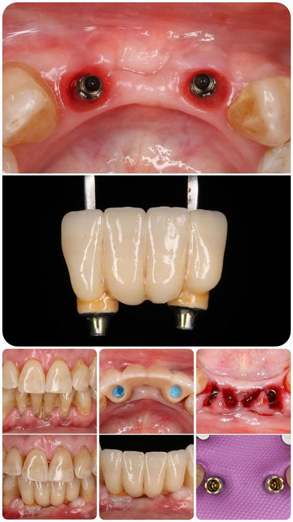 Ivoclar Ivocolor CEREC® Master Kit - Stain and Glaze + Finishing Kit