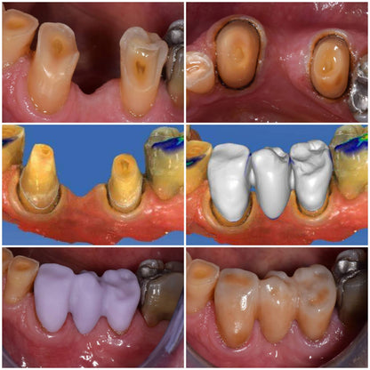 Ivoclar Ivocolor CEREC® Master Kit - Stain and Glaze + Finishing Kit